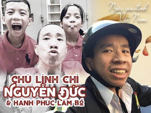 30 năm sau cuộc phẫu thuật tách rời lịch sử chú lính chì hạnh phúc làm bố cặp song sinh