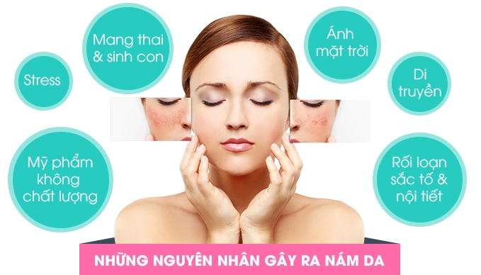 Bị nám da cứ lấy nắm giá đỗ và củ cải làm thế này sau 2 tuần là sạch bách