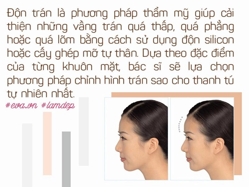 Vừa cải thiện hình dáng trán vừa tạo dáng mũi s-line độn trán thật sự thần kỳ đến vậy