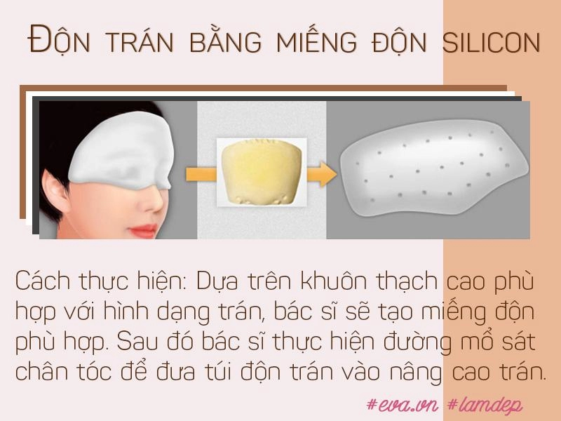 Vừa cải thiện hình dáng trán vừa tạo dáng mũi s-line độn trán thật sự thần kỳ đến vậy