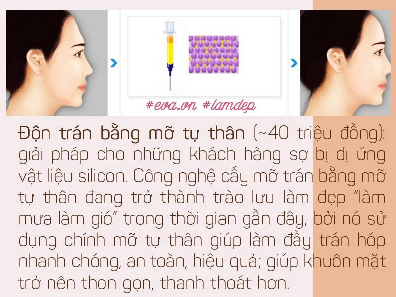 Vừa cải thiện hình dáng trán vừa tạo dáng mũi s-line độn trán thật sự thần kỳ đến vậy