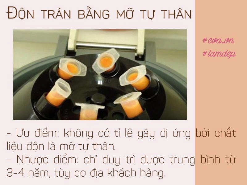 Vừa cải thiện hình dáng trán vừa tạo dáng mũi s-line độn trán thật sự thần kỳ đến vậy