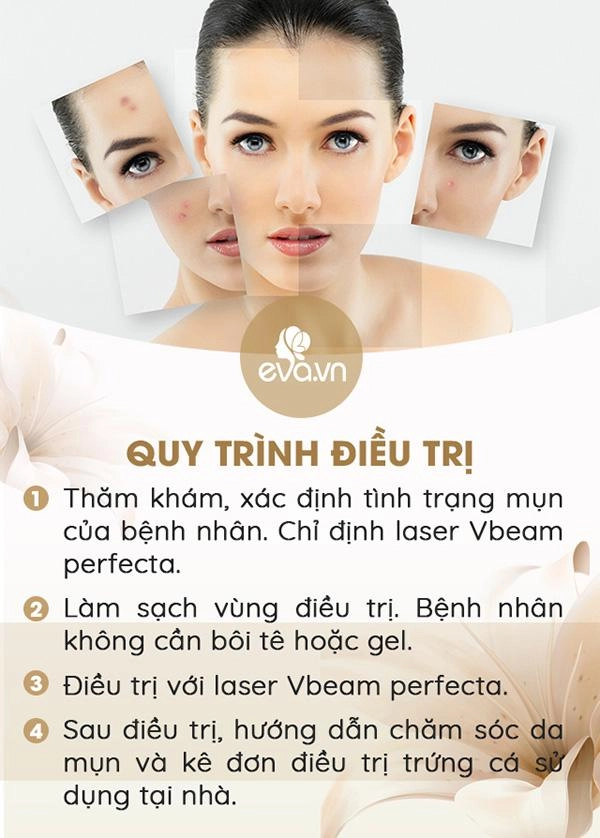 3 ngày nữa noel 7 ngày nữa tết tây làm sao trị mụn trứng cá nhanh mà còn an toàn