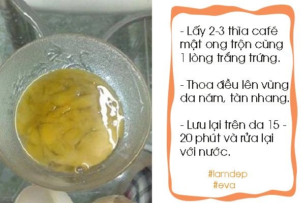 4 cách trị tàn nhang cho trẻ em đơn giản và hiệu quả ngay với cả người lớn