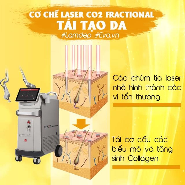 Ai nói trị mụn xong là da auto đẹp thế còn bước hoàn thiện quan trọng này vứt đi đâu
