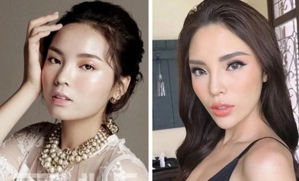 Bí mật đằng sau những chiếc cằm nhọn của sao việt khiến ai cũng muốn thẩm mỹ