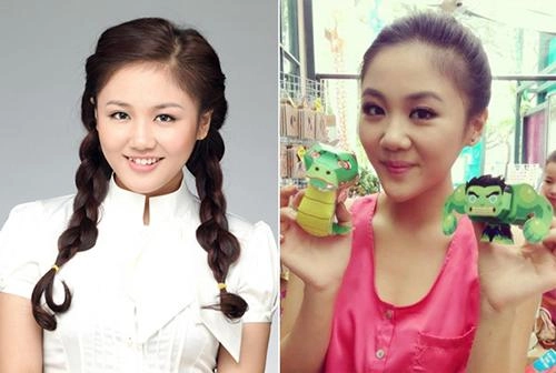 Bí mật đằng sau những chiếc cằm nhọn của sao việt khiến ai cũng muốn thẩm mỹ