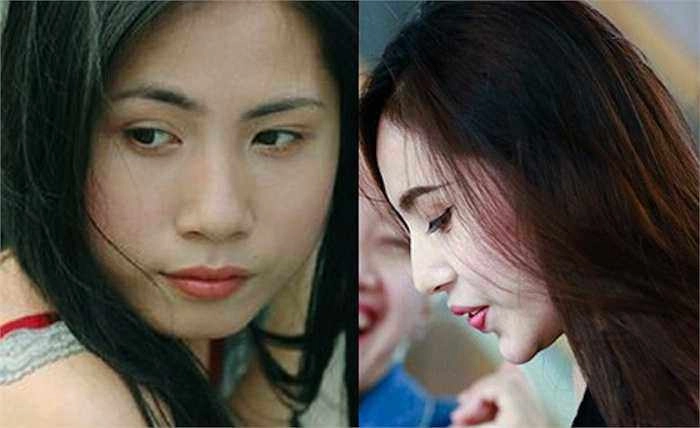 Bí mật đằng sau những chiếc cằm nhọn của sao việt khiến ai cũng muốn thẩm mỹ