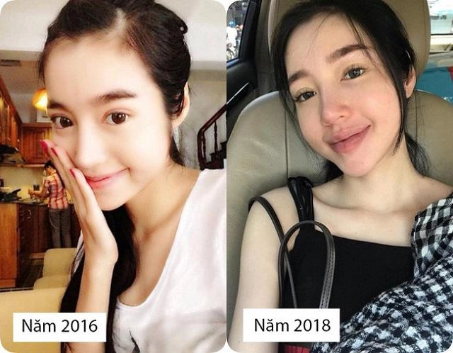 Bình thường đã đẹp rồi vì sao elly trần và 3 bà mẹ đơn thân này vẫn đi sửa mặt