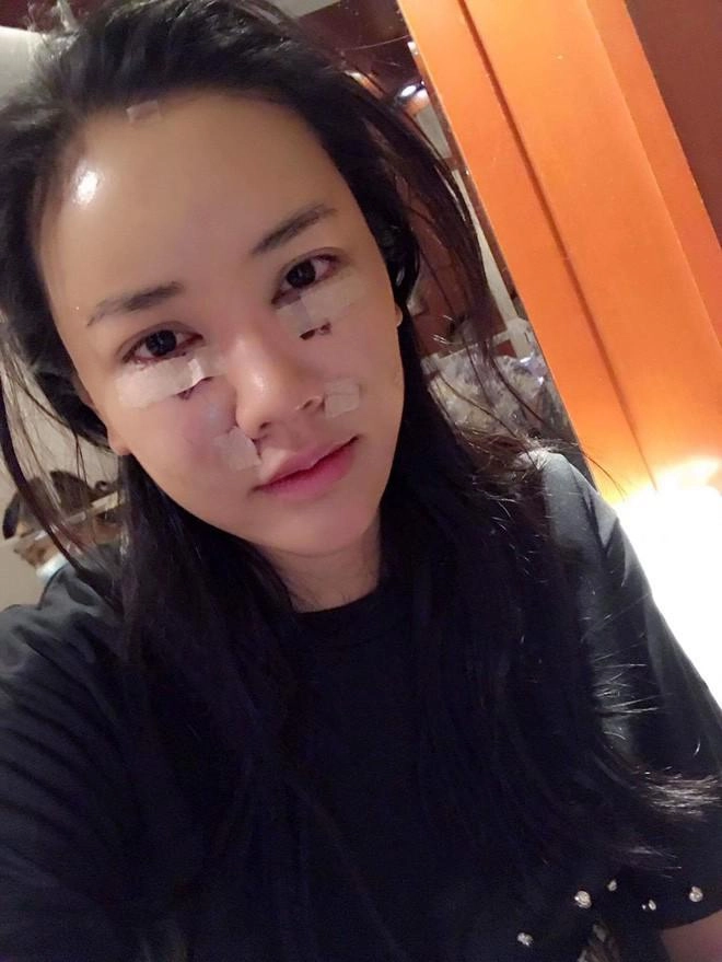 Bình thường đã đẹp rồi vì sao elly trần và 3 bà mẹ đơn thân này vẫn đi sửa mặt