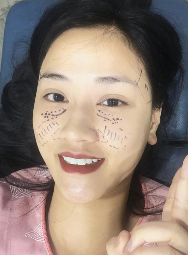 Bình thường đã đẹp rồi vì sao elly trần và 3 bà mẹ đơn thân này vẫn đi sửa mặt