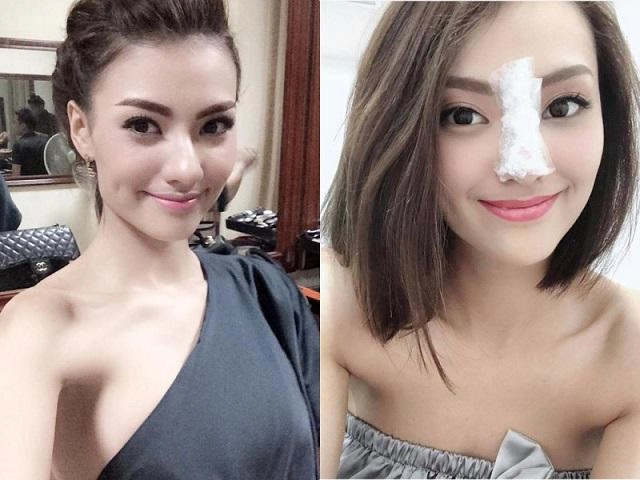 Bình thường đã đẹp rồi vì sao elly trần và 3 bà mẹ đơn thân này vẫn đi sửa mặt