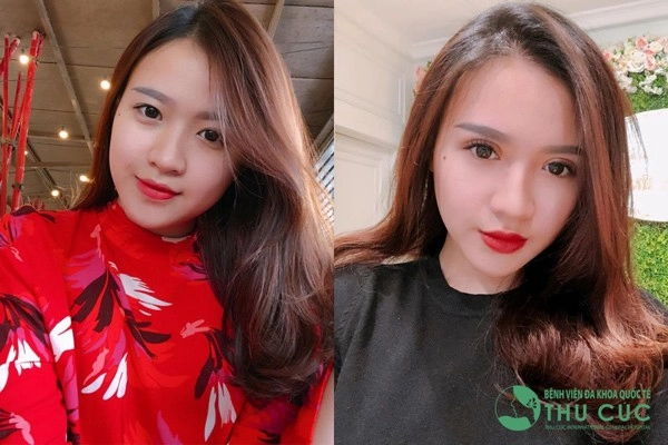 Cả thế giới ra đây mà xem con gái ai cũng cắt mí rồi