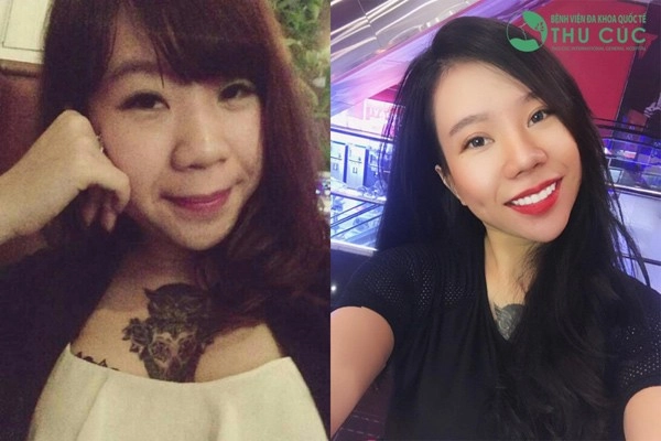 Cả thế giới ra đây mà xem con gái ai cũng cắt mí rồi