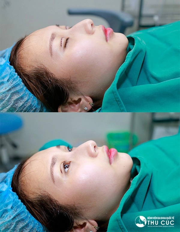 Cả thế giới ra đây mà xem con gái ai cũng cắt mí rồi