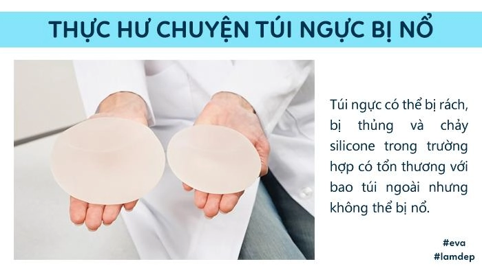 Câu trả lời bất ngờ từ chuyên gia túi ngực có thế bị rách thủng chứ không thể bị nổ