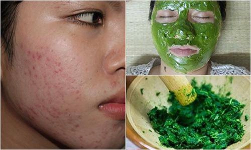Chạy ra chợ mua nắm rau má về xay nhuyễn rồi đắp lên mặt sẹo lõm đến mấy cũng khỏi