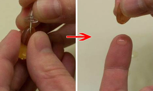 Chạy ra chợ mua nắm rau má về xay nhuyễn rồi đắp lên mặt sẹo lõm đến mấy cũng khỏi