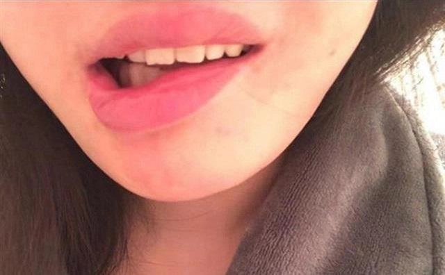 Chi 100 triệu để trùng tu nhan sắc cô gái khóc ròng khi nhận kết quả khủng khiếp