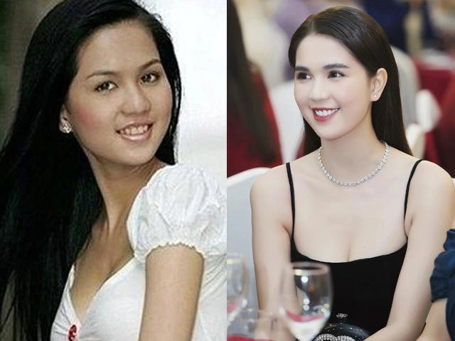 Chị em tuổi băm mà vẫn muốn niềng răng hãy đọc ngay bài viết này