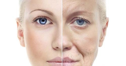Chi tiền và mạo hiểm dao kéo nhưng bạn có biết nhấn mí kéo dài được bao lâu không