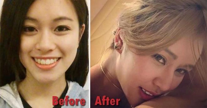 Chiều lòng bạn trai mỹ nhân hồng kông trải qua 30 cuộc phẫu thuật thẩm mỹ đầy đau đớn