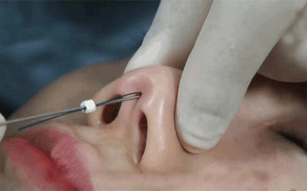 Chuyện tình đại gia đổ vỡ tự nuôi con sự nghiệp tụt dốc hồng quế sửa mũi để đổi vận