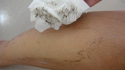 Có 2 cách triệt lông chân chưa đến 10 ngàn đồng này nàng tha hồ diện bikini chào hè nhé