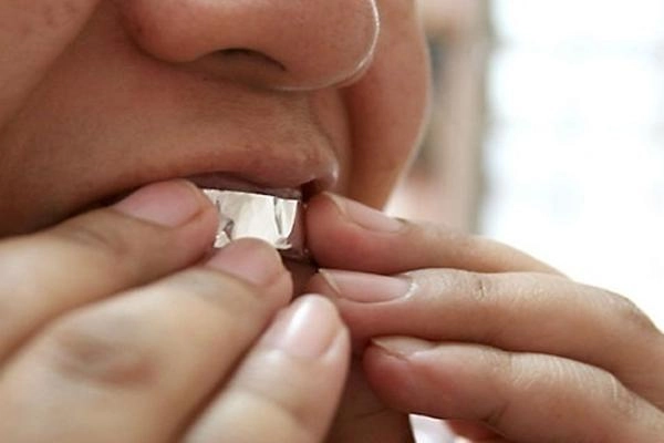Còn ít ngày nữa là tết bỏ túi ngay các bí kíp tẩy trắng răng cực hiệu quả sau đây