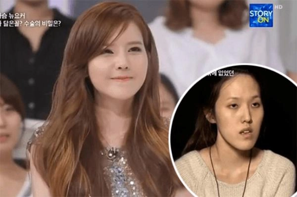 Đẻ 3 con khổ sở khi ngực gần như tiêu biến mẹ bỉm sữa quyết định đụng chạm dao kéo