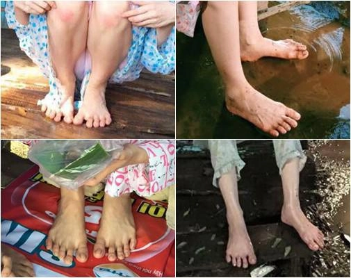 Đẹp như ngọc trinh hà hồ minh hằng cũng có khuyết điểm dù chi tiền tỷ vẫn không thể cứu