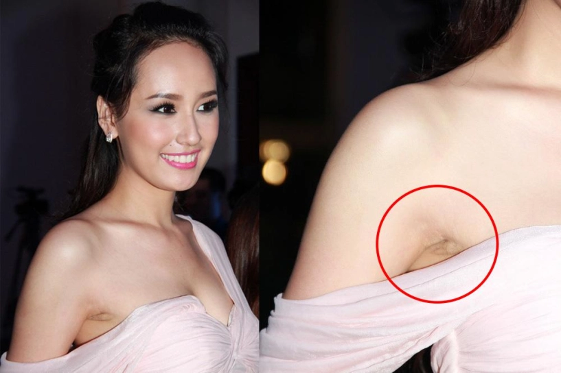 Đẹp như sao việt cũng có lúc lộ cả dàn khuyết điểm như thế này