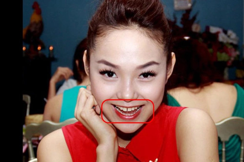 Đẹp như sao việt cũng có lúc lộ cả dàn khuyết điểm như thế này