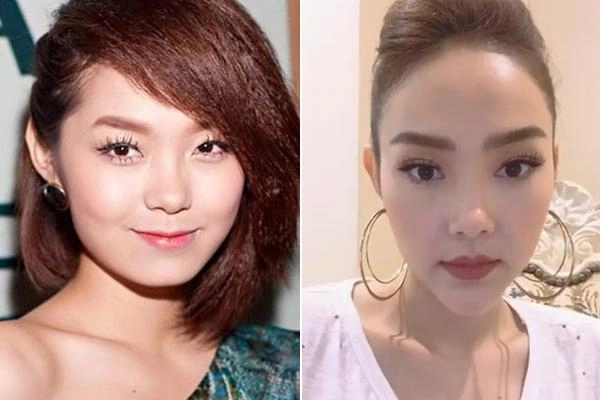 Điểm danh 3 bộ phận được các sao việt kéo bè kéo phái trùng tu nhiều nhất năm 2018