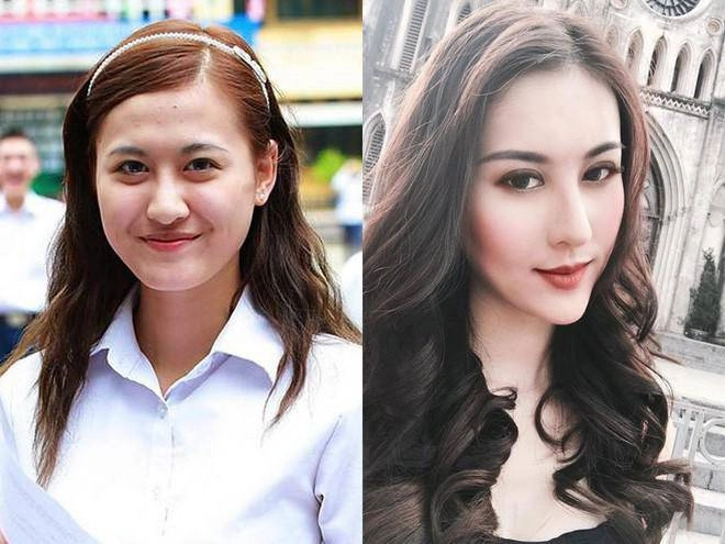 Điểm danh 3 bộ phận được các sao việt kéo bè kéo phái trùng tu nhiều nhất năm 2018