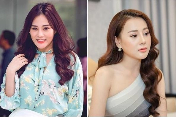 Điểm danh 3 bộ phận được các sao việt kéo bè kéo phái trùng tu nhiều nhất năm 2018