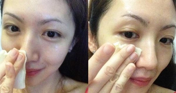 Đừng lo đẻ xong sẽ xấu vì đã có 3 cách chăm sóc da mặt sau sinh cho các chị