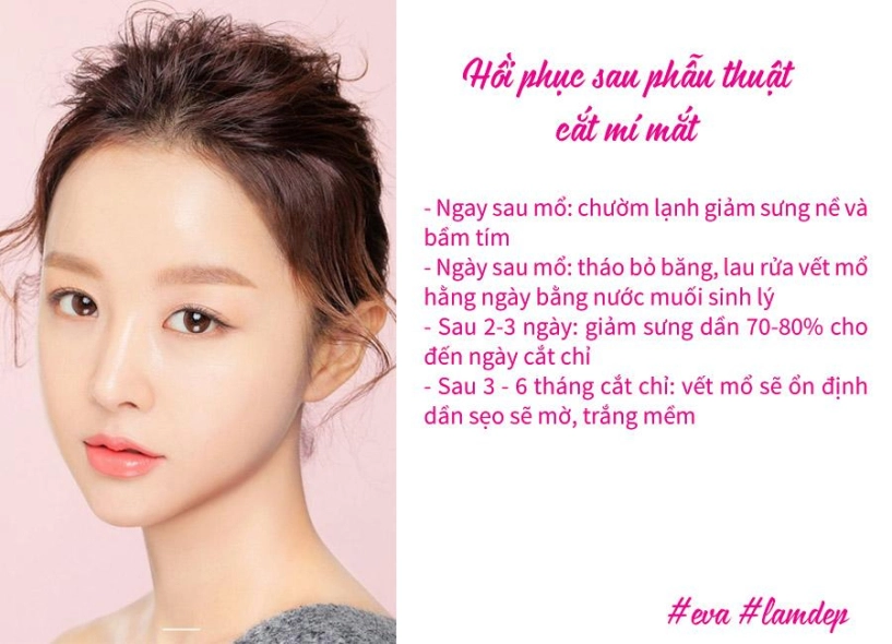 Giải đáp 5 câu hỏi thường gặp khiến chị em băn khoăn trước khi thẩm mỹ mắt