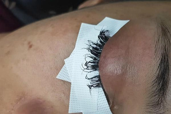 Ham rẻ cô gái này suýt hỏng mắt vì nối mi bằng keo dán sắt