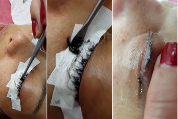 Ham rẻ cô gái này suýt hỏng mắt vì nối mi bằng keo dán sắt
