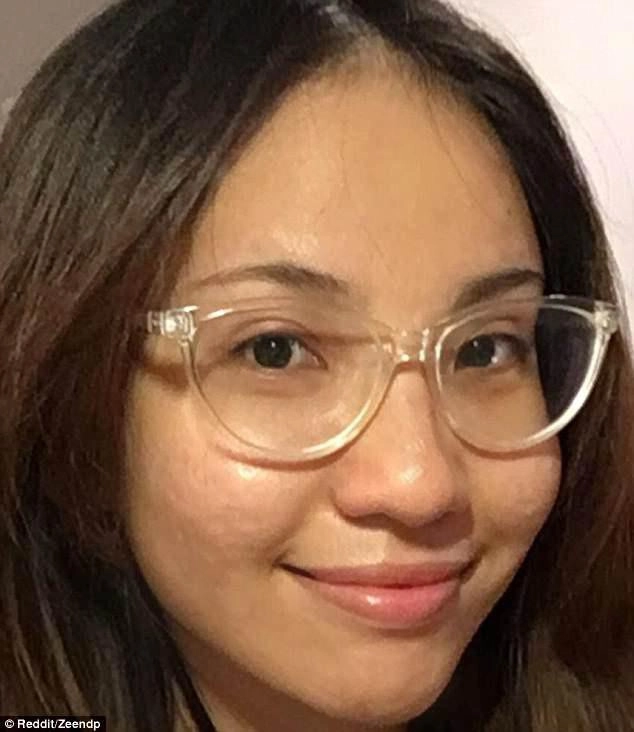 Hành trình trị mụn kiên trì 11 năm của cô gái gốc việt gây chấn động báo nước ngoài