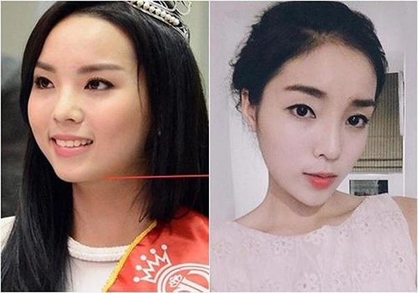 Hậu tin đồn dao kéo phải công nhận giờ đây kỳ duyên đạt đến đỉnh cao của nhan sắc