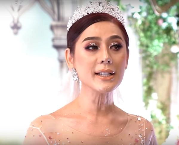 Hết da đen sạm mặt đầy nếp nhăn lâm khánh chi lại gây choáng với vùng cổ chảy xệ