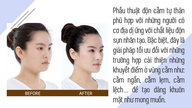 Hết gọt đến độn bằng silicon giờ đây chị em tìm đến phương pháp trượt với chính cằm của mình