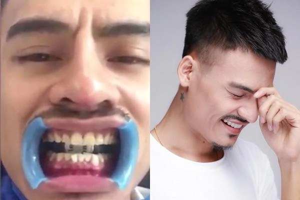Hết sửa mũi hoa vinh tiếp tục làm răng xăm lông mày chuẩn bị tiến vào showbiz