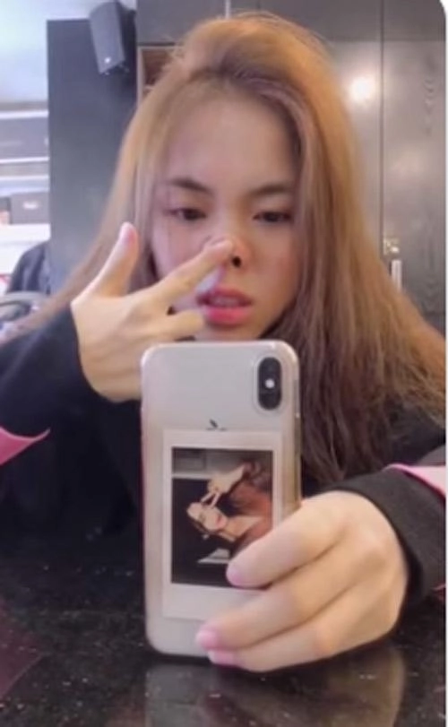 Hoà minzy tự đấm vào mặt véo mũi chứng minh không hề phẫu thuật thẩm mỹ