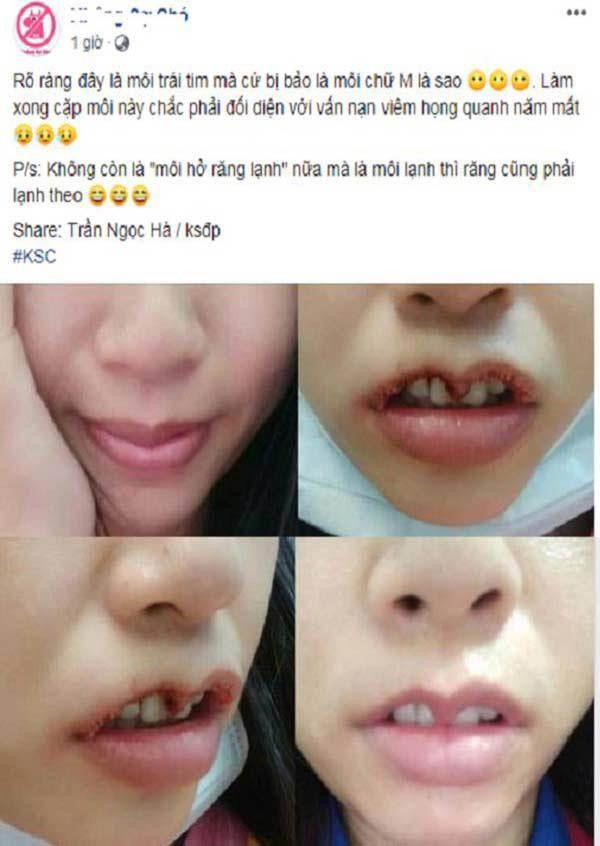 Khi bạn muốn đôi môi trái tim còn bác sĩ lại muốn khắc nguyên hình trái tim lên mặt bạn
