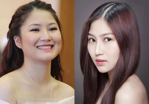 Không chỉ thích cằm nhọn vline những sao nữ vbiz còn thích thẩm mỹ bộ phận này trên cơ thể