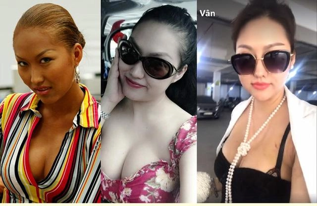 Không chỉ thích cằm nhọn vline những sao nữ vbiz còn thích thẩm mỹ bộ phận này trên cơ thể