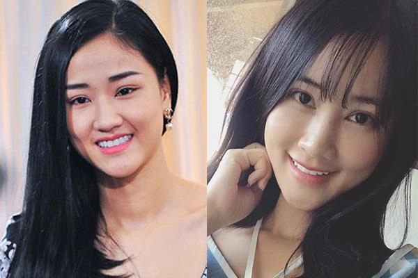 Không chỉ thích cằm nhọn vline những sao nữ vbiz còn thích thẩm mỹ bộ phận này trên cơ thể